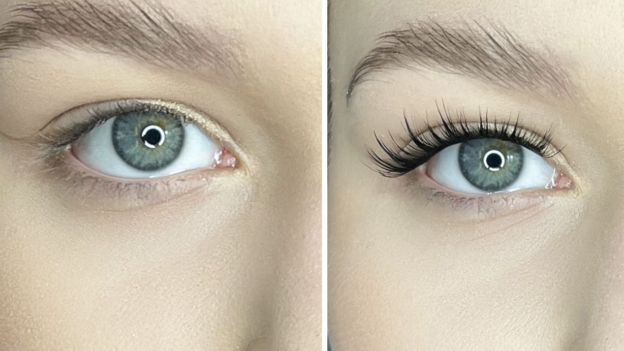 ripsienpidennyssarja kotona - parhaat sarjat